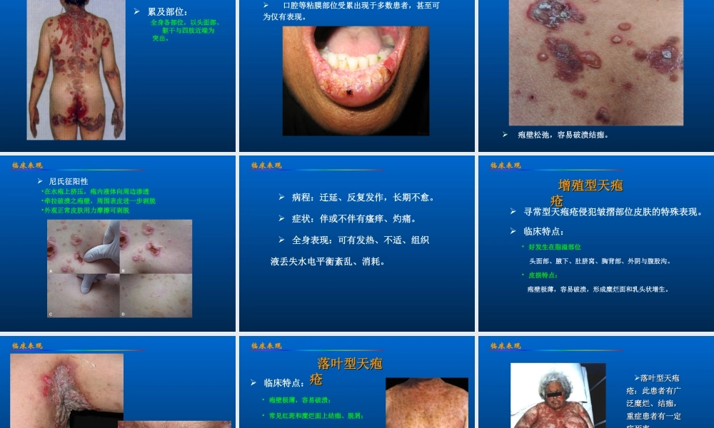 大疱性皮肤病.ppt