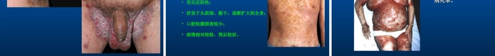 大疱性皮肤病.ppt