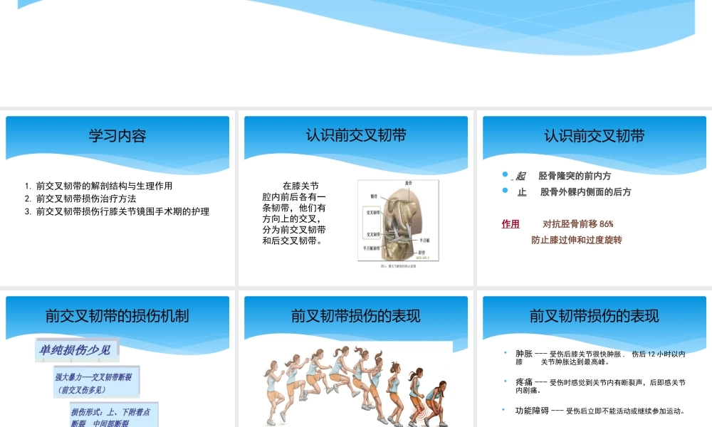 前交叉韧带损伤的教学查房.pptx