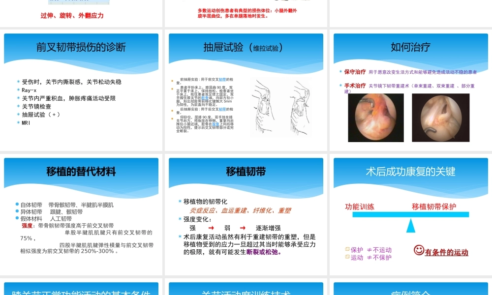 前交叉韧带损伤的教学查房.pptx