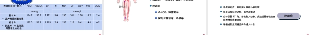 动脉血气分析操作.ppt