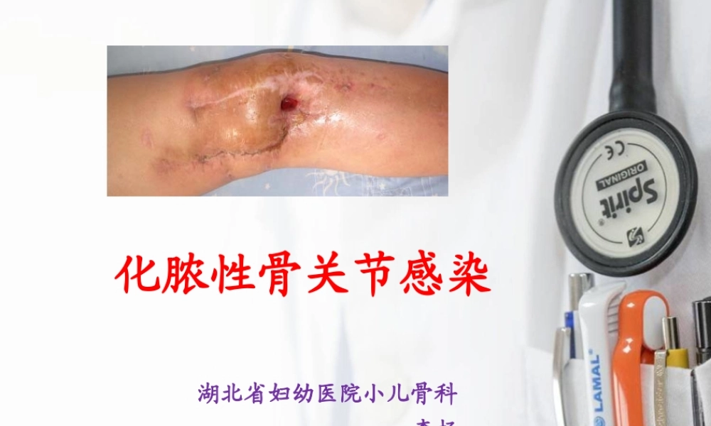 化脓性关节炎查房.ppt