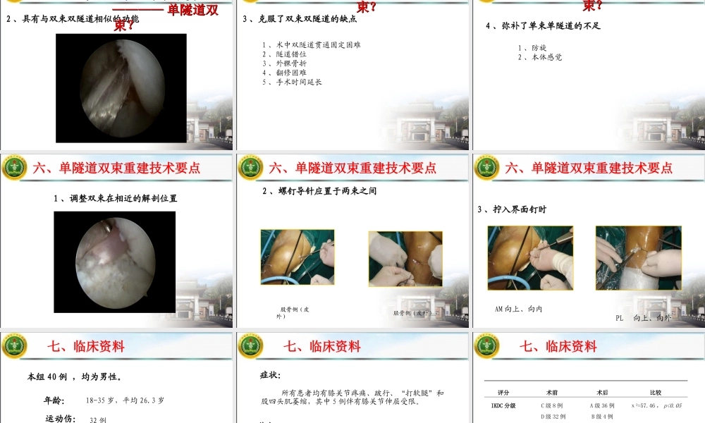 单隧道双束前交叉韧带重建的中期疗效观察.ppt