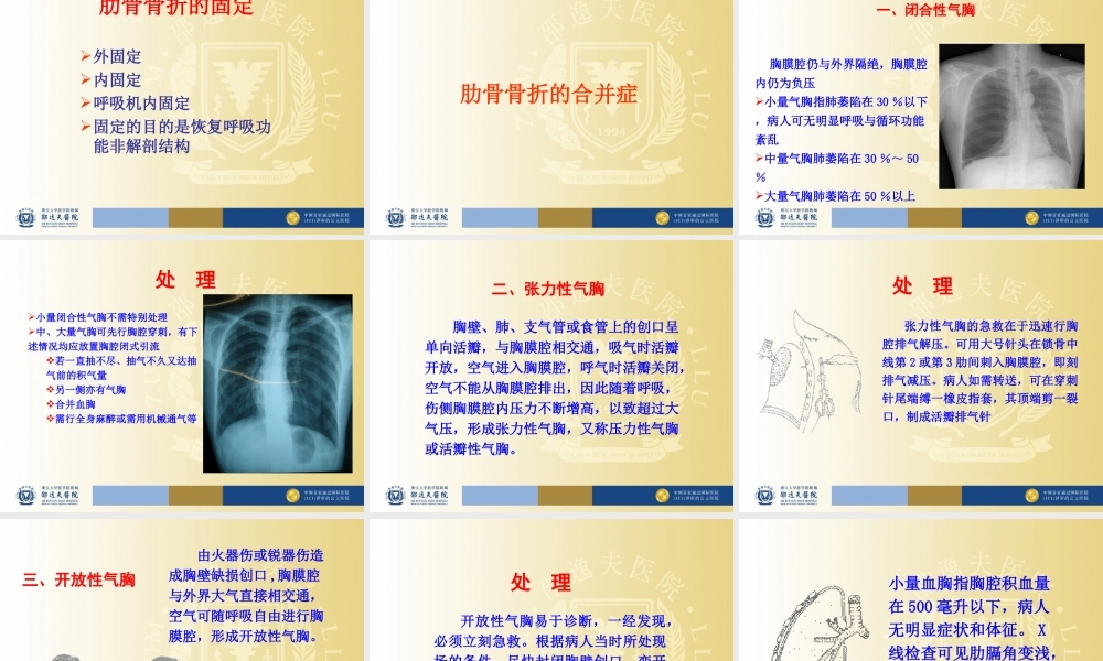 多根肋骨骨折胸腔不稳定型.ppt