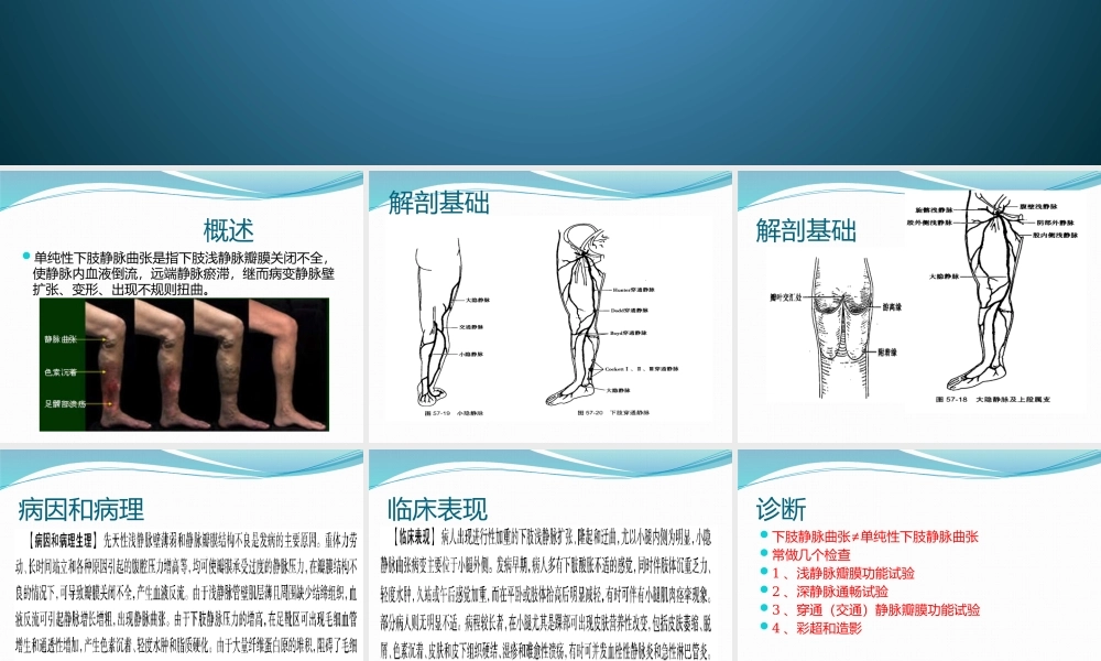单纯性下肢静脉曲张.pptx