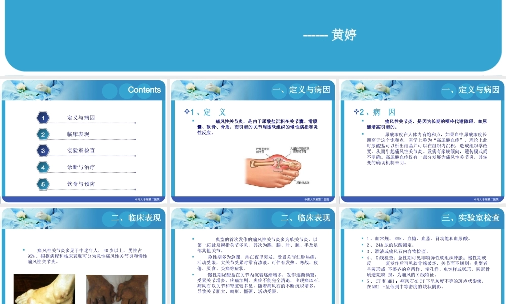 关节炎--黄婷(1).pptx