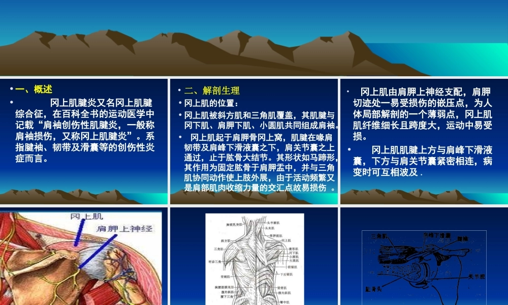 冈上肌肌腱炎.ppt