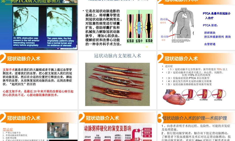 冠脉介入术.ppt