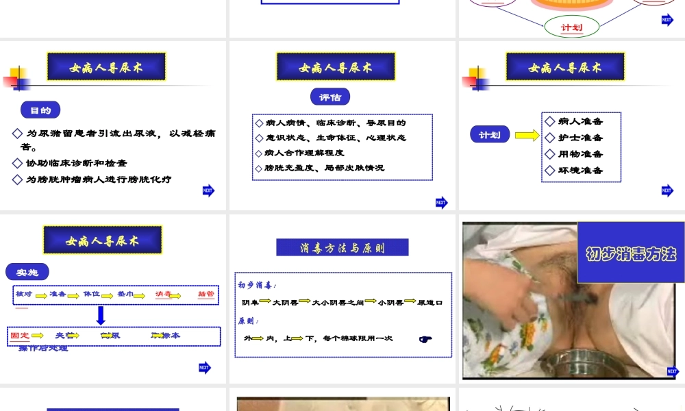 女病人导尿术.ppt