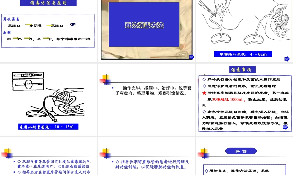 女病人导尿术.ppt