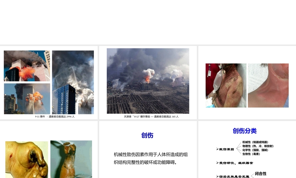 创伤与烧伤的处理.pptx