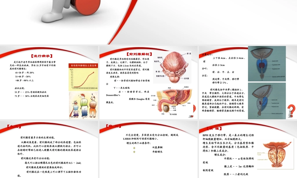 前列腺增生症.PPT.ppt