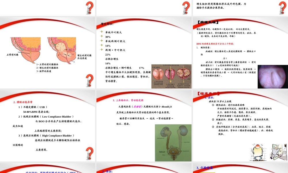 前列腺增生症.PPT.ppt