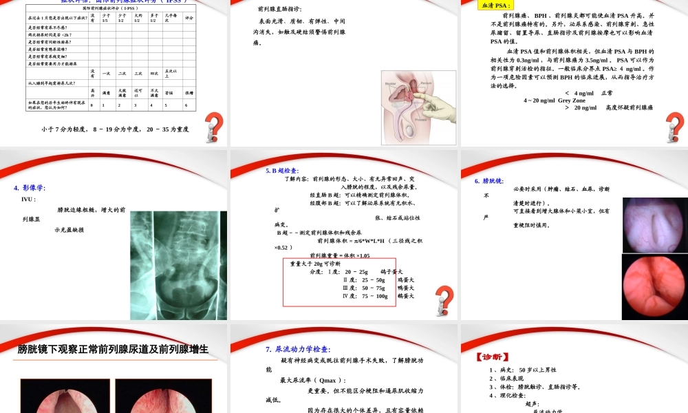 前列腺增生症.PPT.ppt