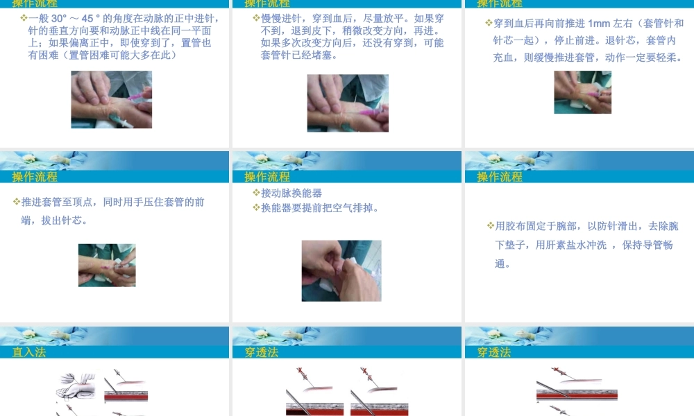 动脉穿刺.ppt