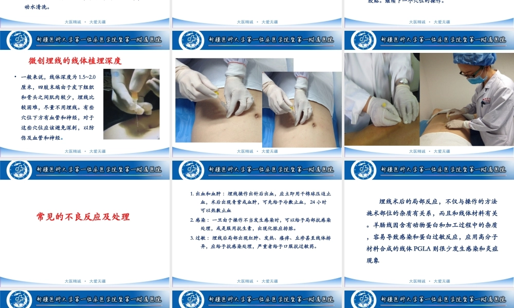 周钰-穴位埋线疗法及新进展.ppt