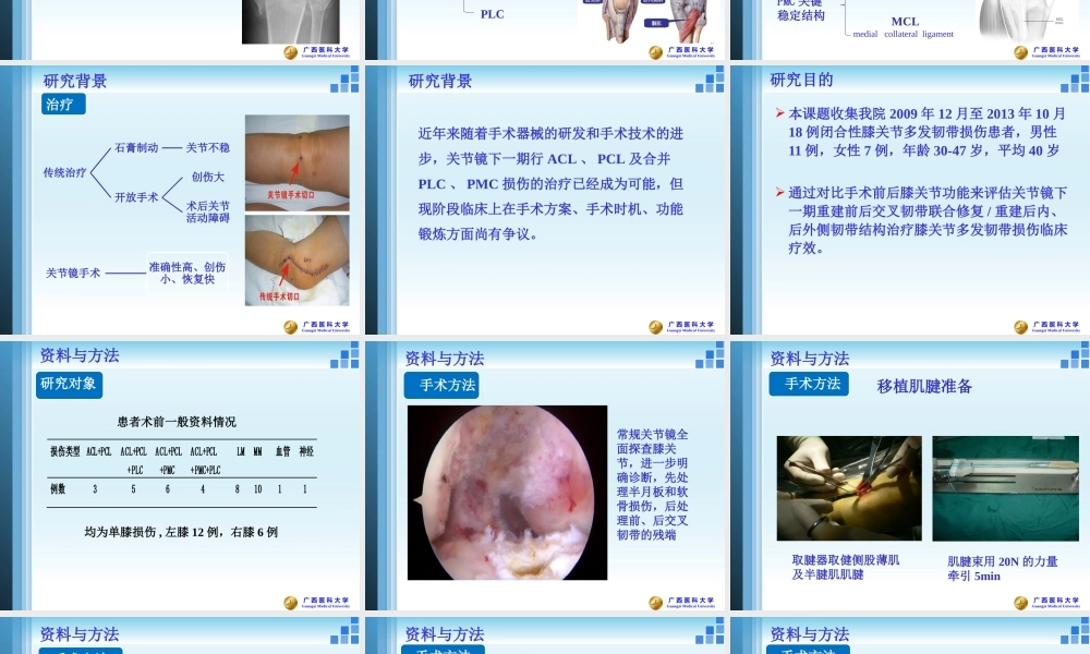 关节镜膝关节多发韧带损伤的修复.pptx