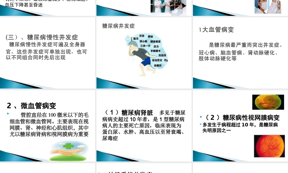 内4科——内分泌科常见病简介.ppt