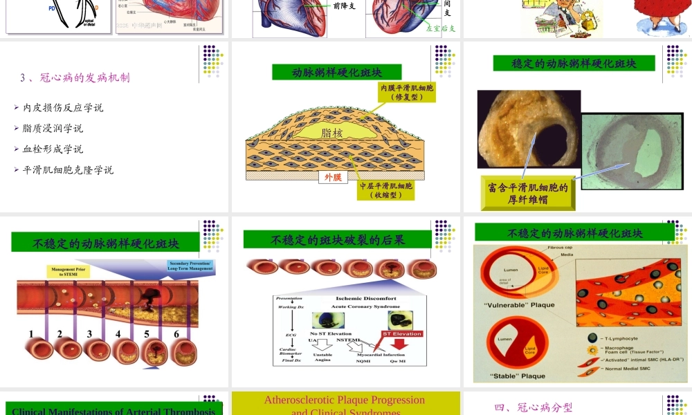 冠状动脉粥样硬化性.ppt