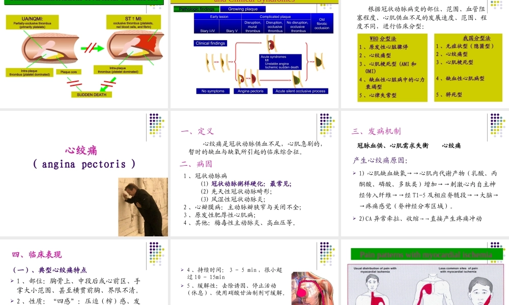 冠状动脉粥样硬化性.ppt