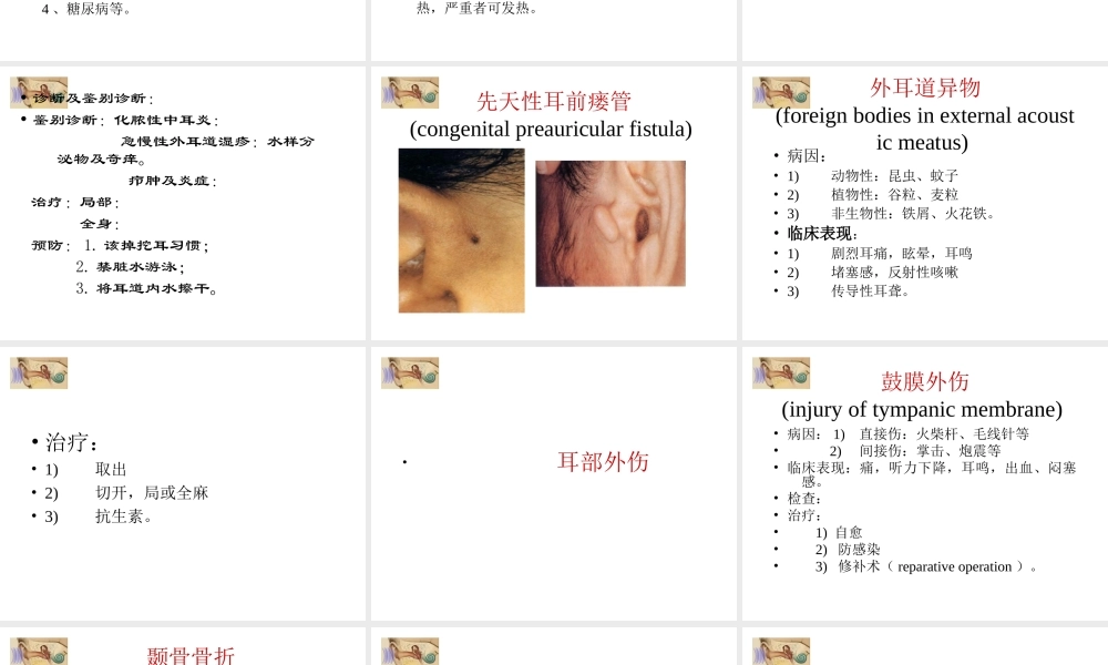 分泌性中耳炎-大连医科大学附属第二医院.ppt