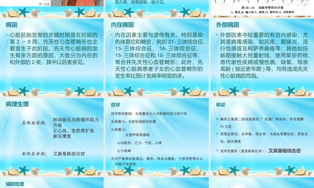 动脉导管未闭9.ppt