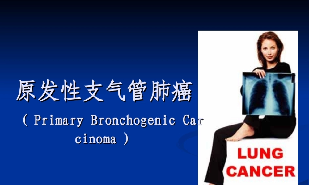 原发性支气管肺癌详解.ppt