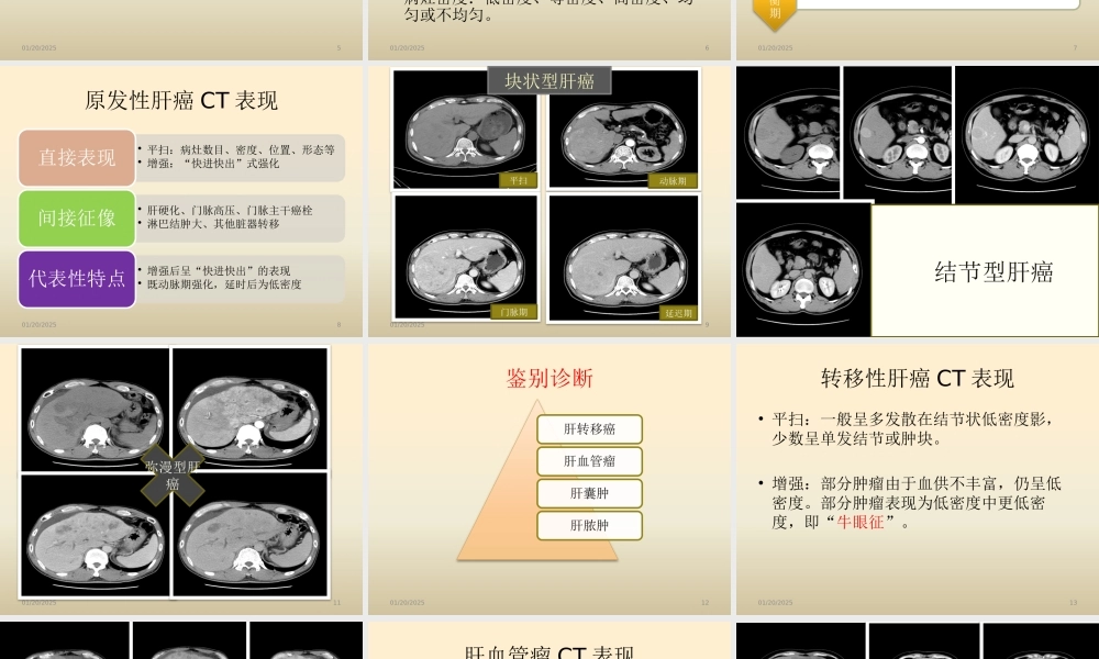原发性肝癌CT表现与鉴别.pptx