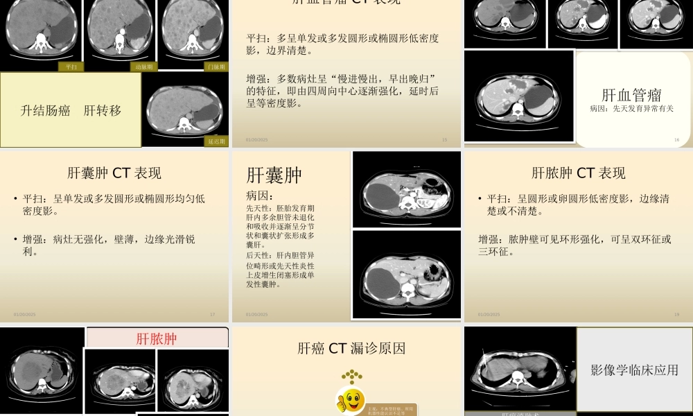 原发性肝癌CT表现与鉴别.pptx