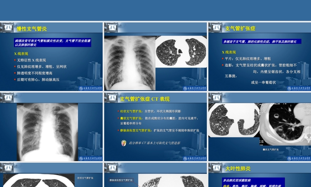 呼吸系统影像学基础.ppt