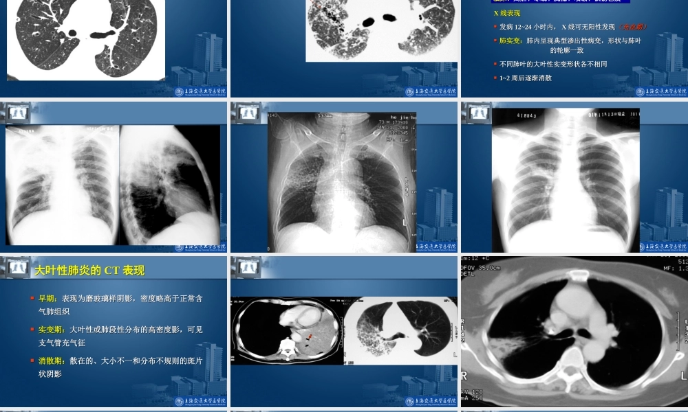呼吸系统影像学基础.ppt