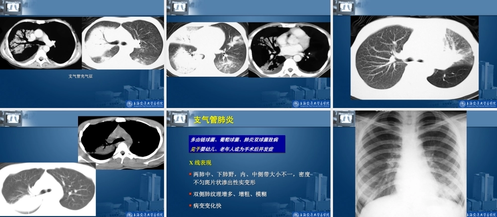 呼吸系统影像学基础.ppt