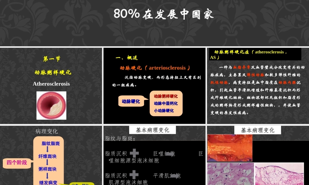 动脉粥样硬化和高血压(1).ppt