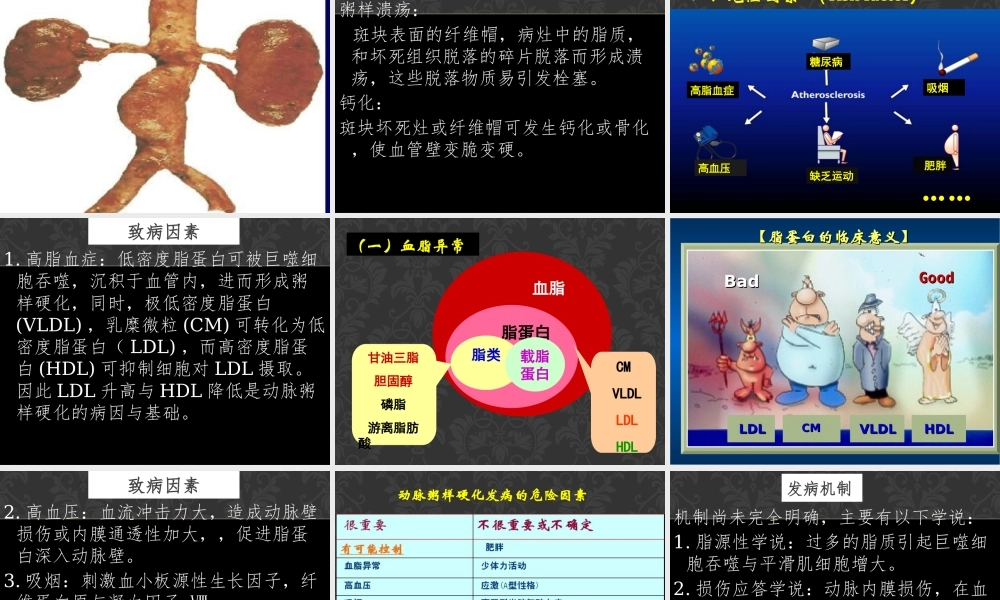 动脉粥样硬化和高血压(1).ppt