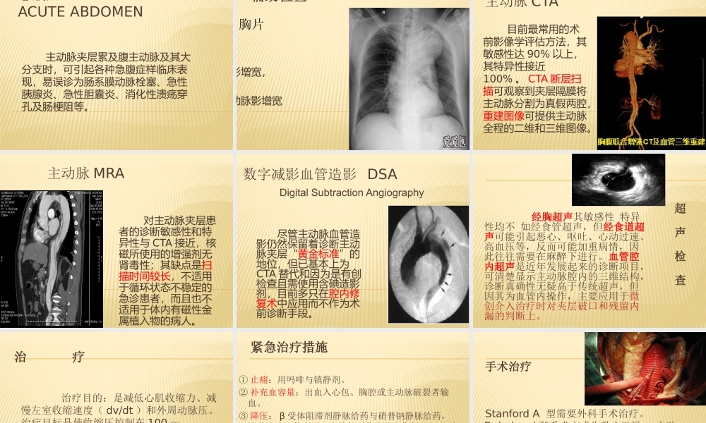 主动脉夹层-ppt.pptx