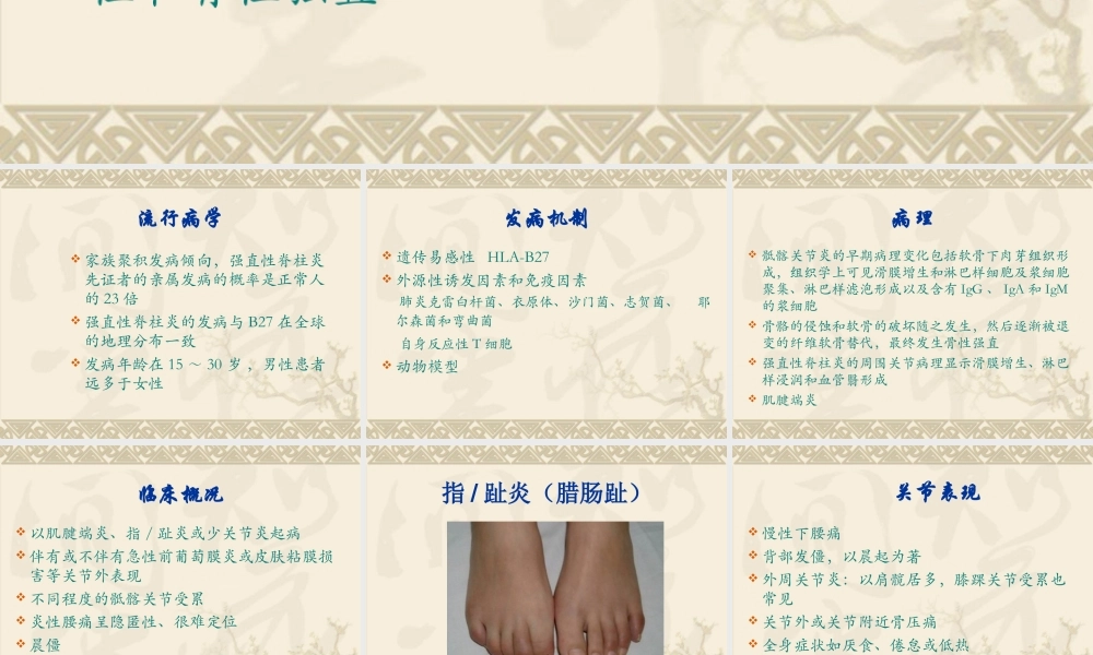 中西医结合骨伤-强直性脊柱炎.ppt