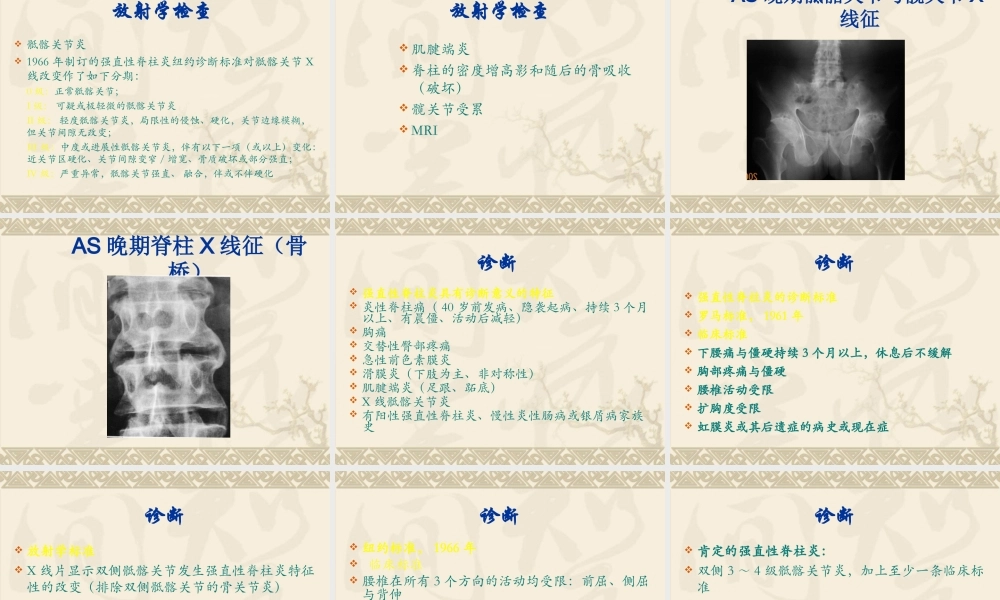 中西医结合骨伤-强直性脊柱炎.ppt