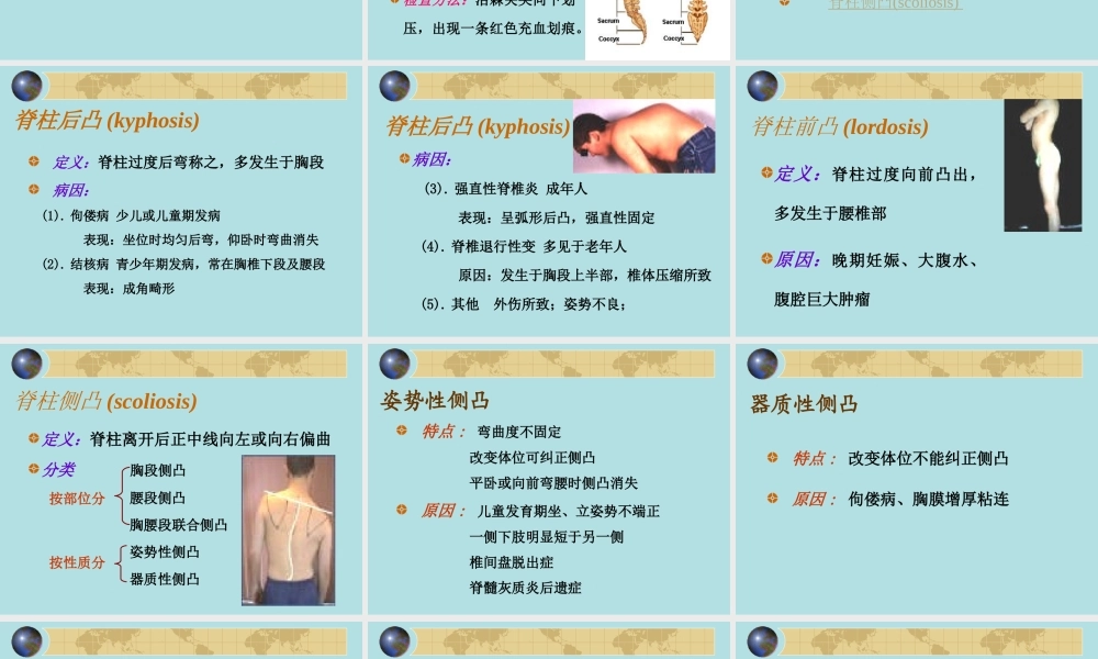 健康评估脊柱四肢.ppt