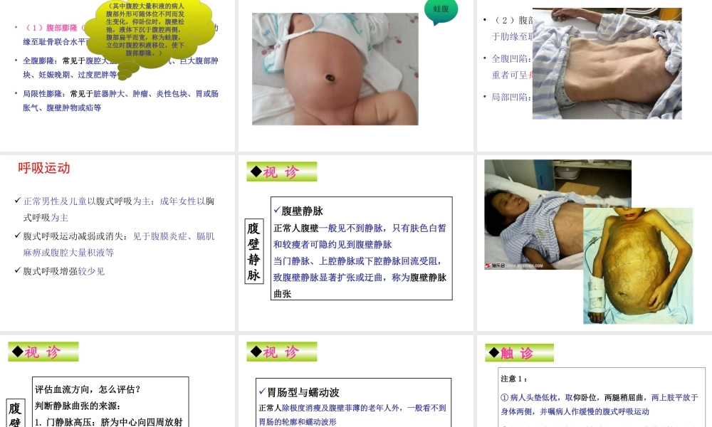 健康评估-腹部评估.ppt