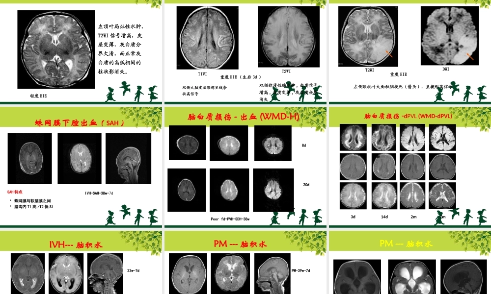 儿童康复的相关检.pptx