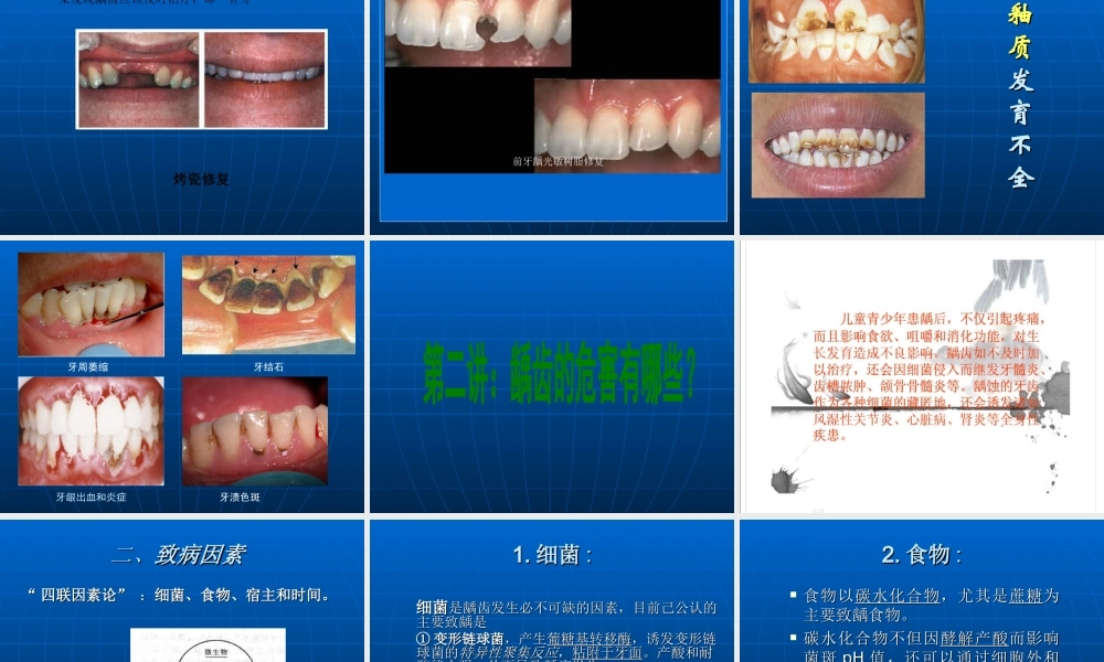 儿童常见病的防治李.ppt