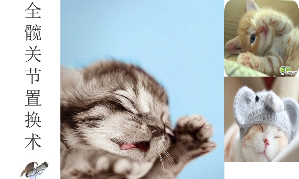 全款关节置换术后功能锻炼.ppt