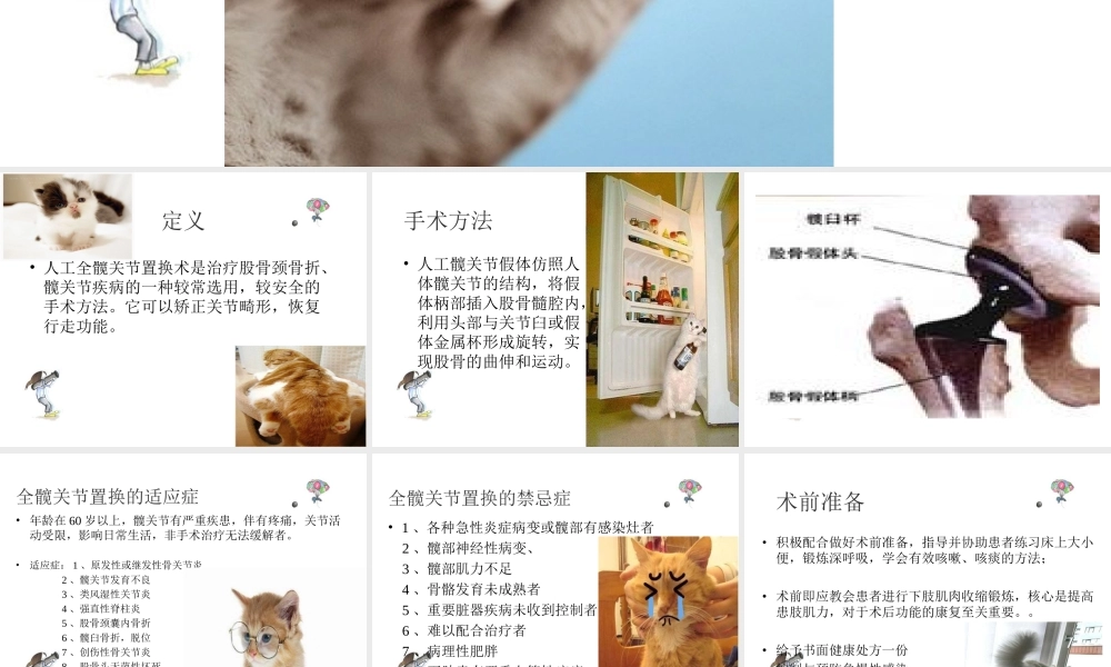 全款关节置换术后功能锻炼.ppt