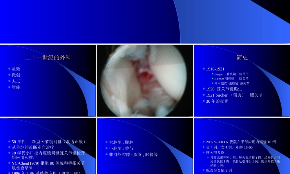 内窥镜在手外科的应用.ppt