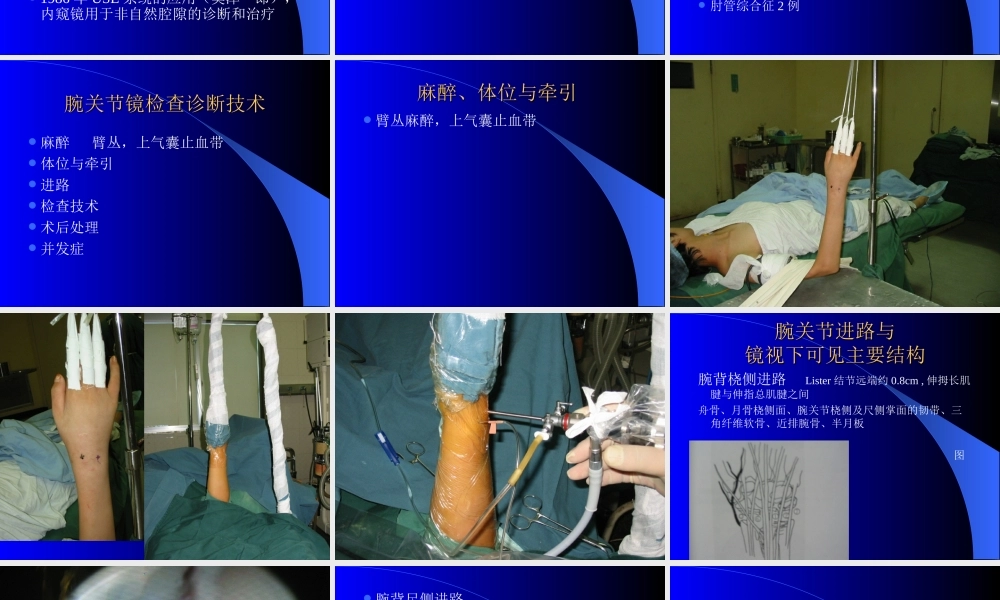 内窥镜在手外科的应用.ppt