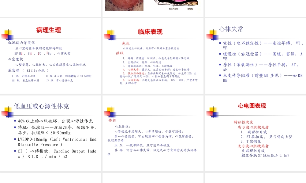 冠心病急性心肌梗死.ppt