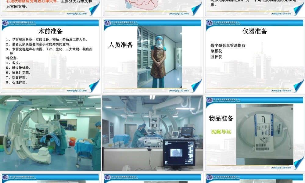 冠状动脉造影术--徐同亮.ppt