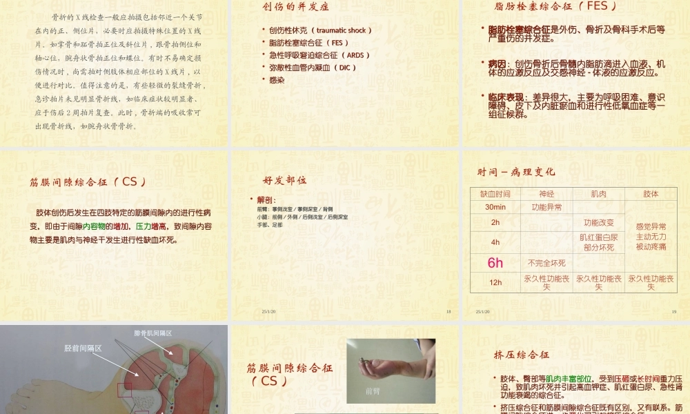 创伤骨科基础知识.ppt