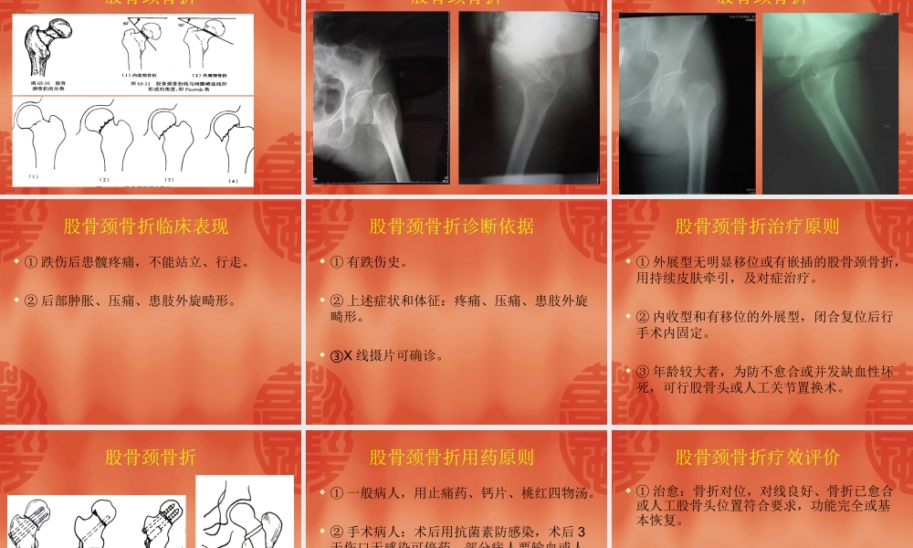 利于骨痂形成促进骨折愈合.ppt