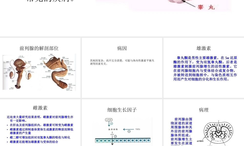 前列腺增生症.ppt